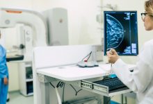 exigen-10-radiologos-y-la-intervencion-de-la-fiscalia-en-talavera-de-la-reina